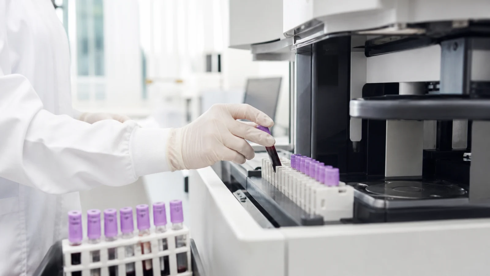 AMH testinin klinik laboratuvarda değerlendirilmesi